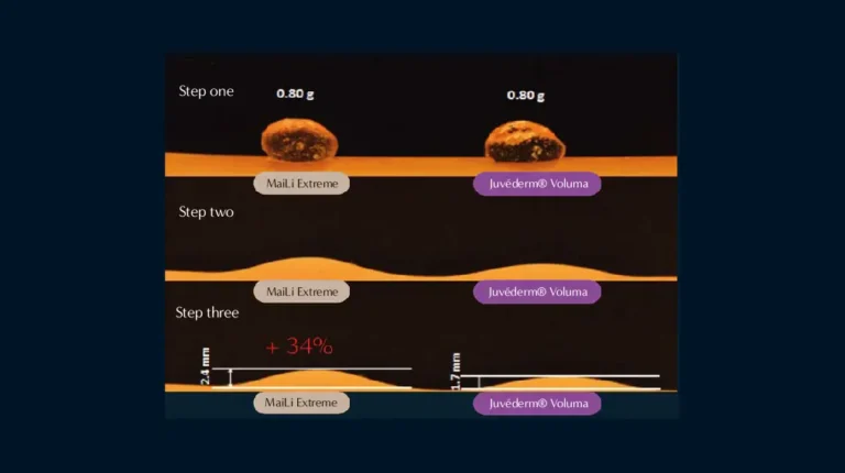 benefit-images-02 benefit-images-02